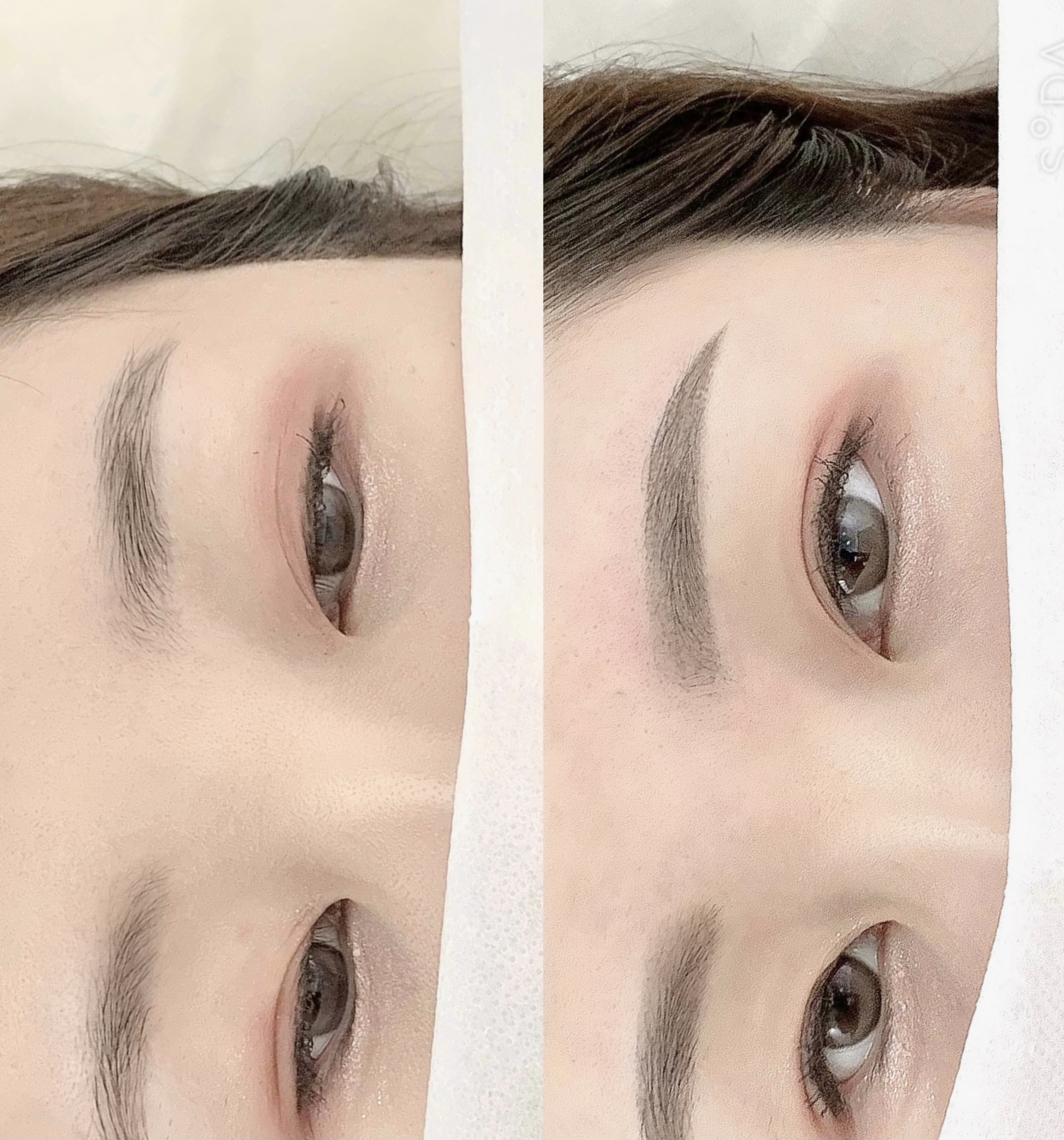 디어린 대표 이미지