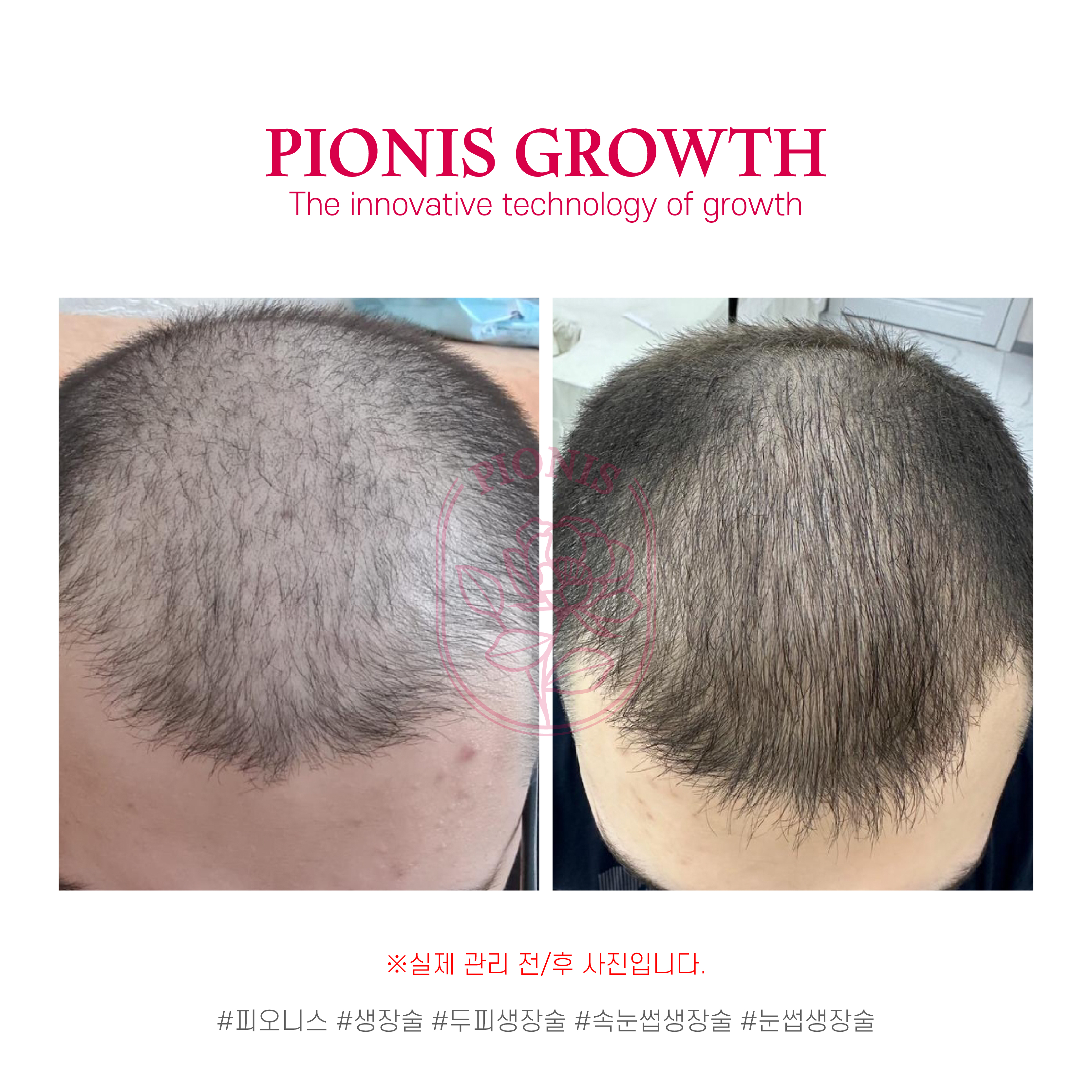 썸뷰티 대표 이미지