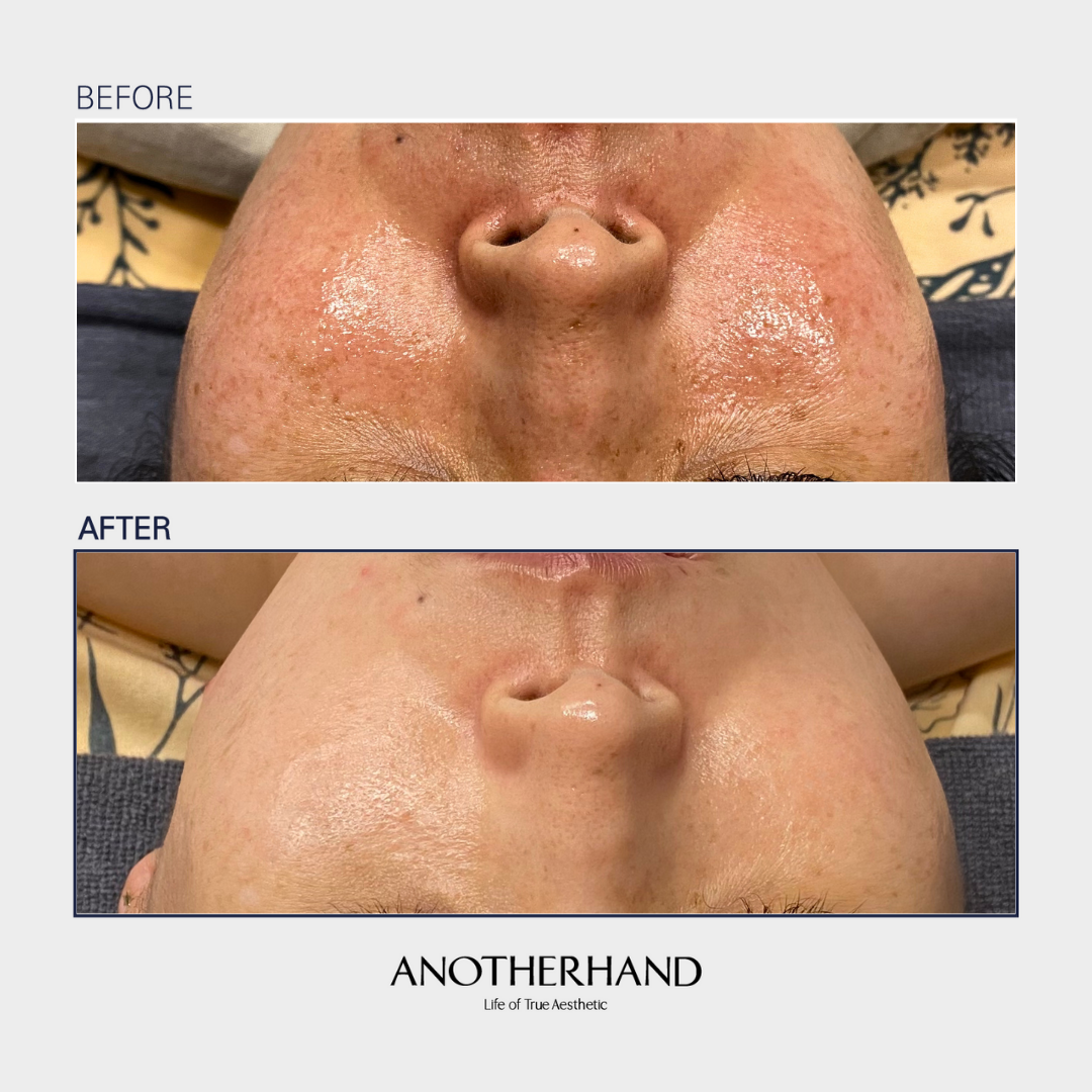 어나더핸드 이미지