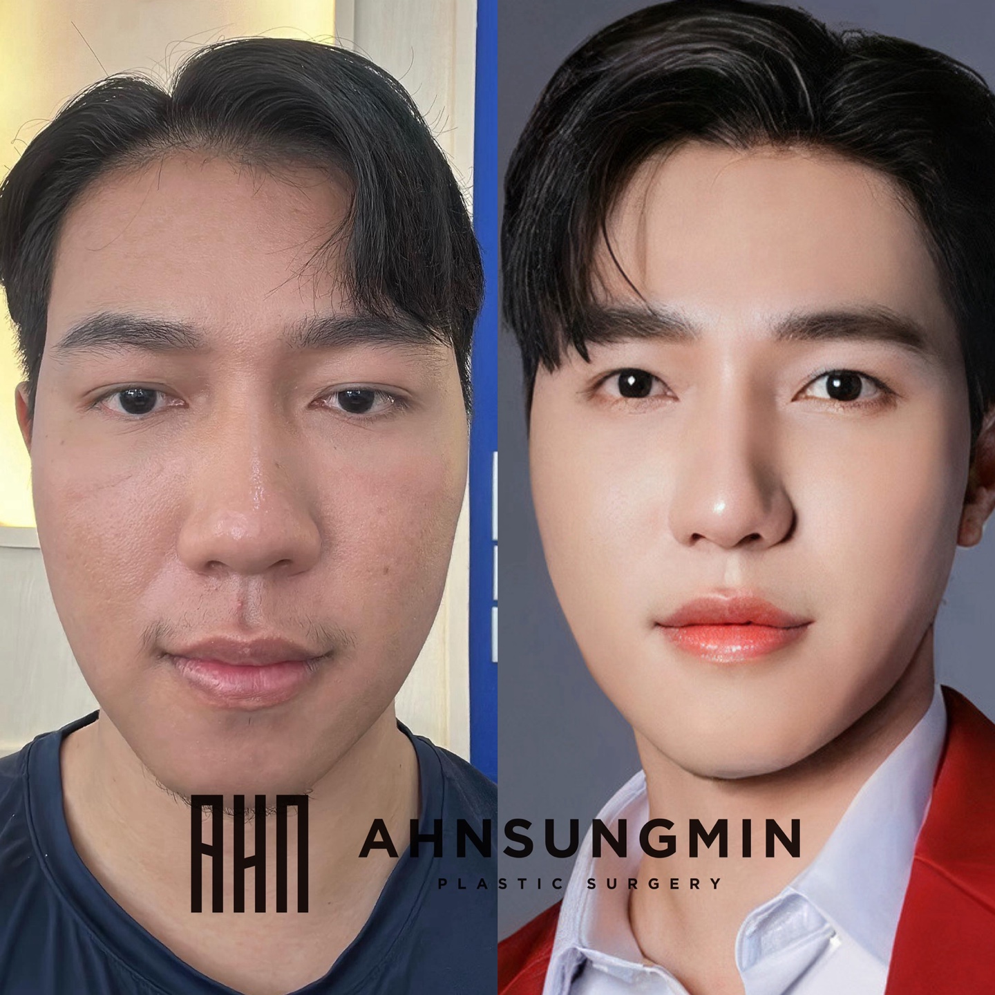 안성민성형외과 대표 이미지
