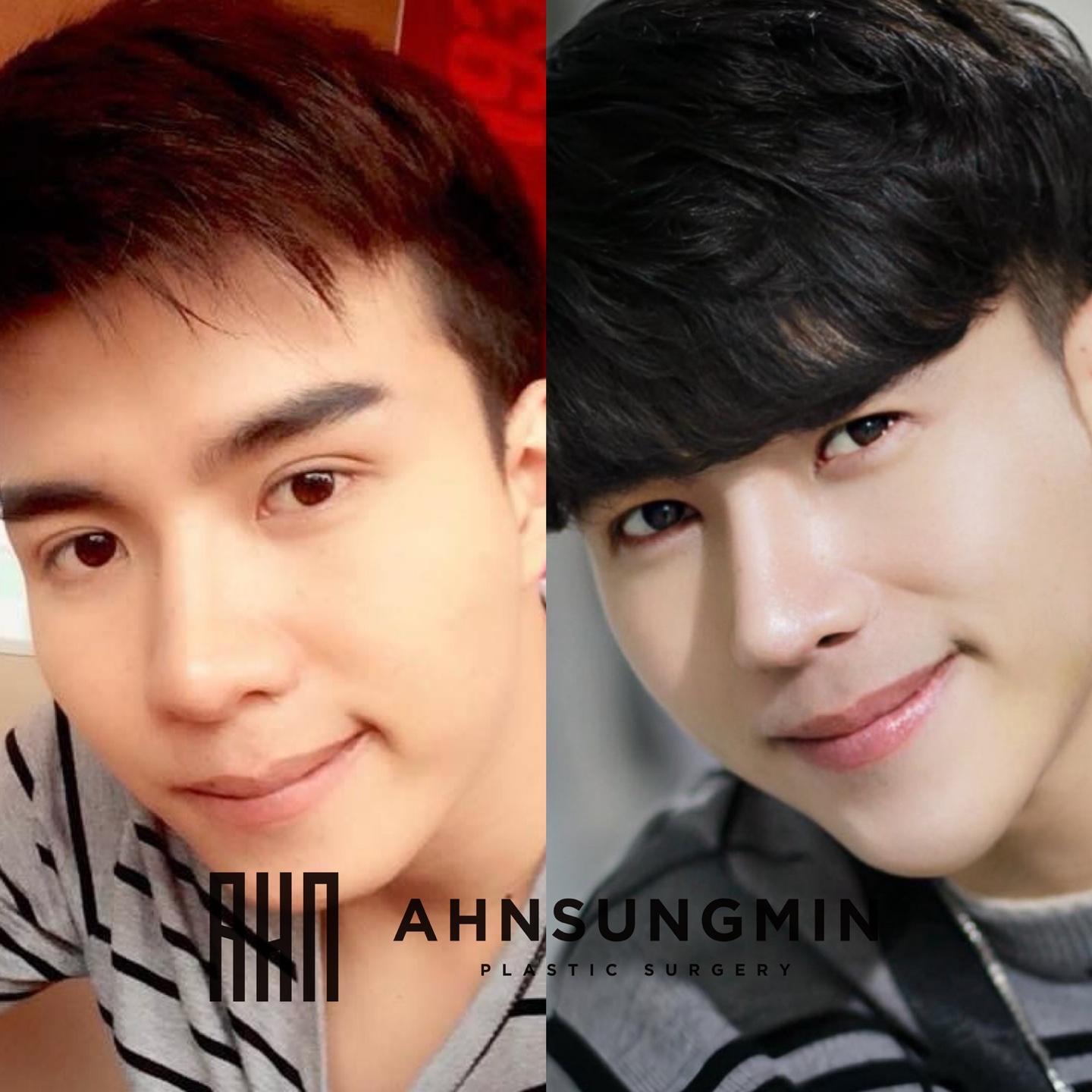 안성민성형외과의원 대표 이미지