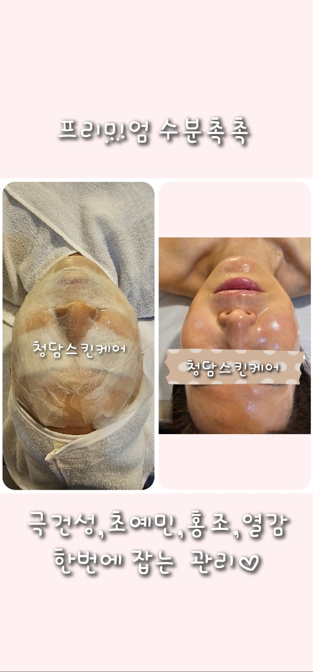 청담스킨케어