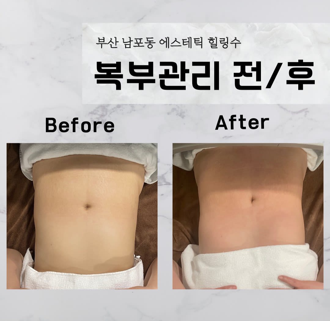에스테틱 힐링수