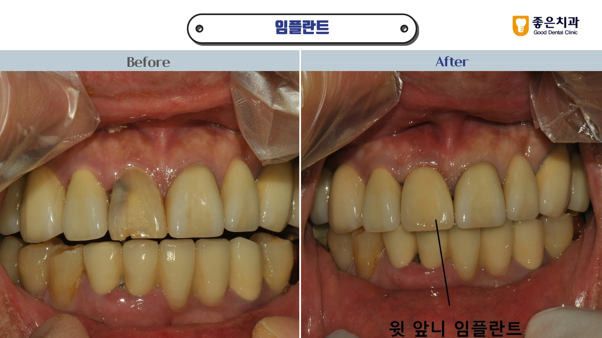좋은치과의원 서면 대표 이미지