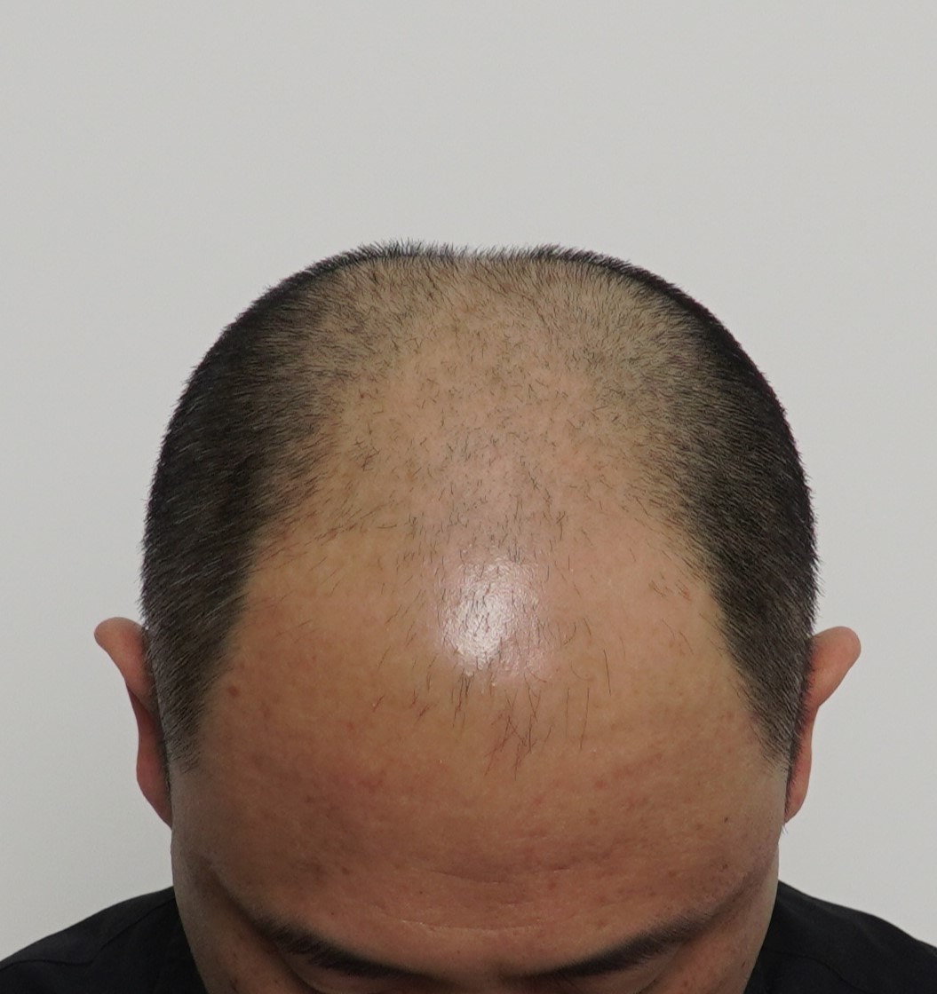 코지도트스칼프 대표 이미지