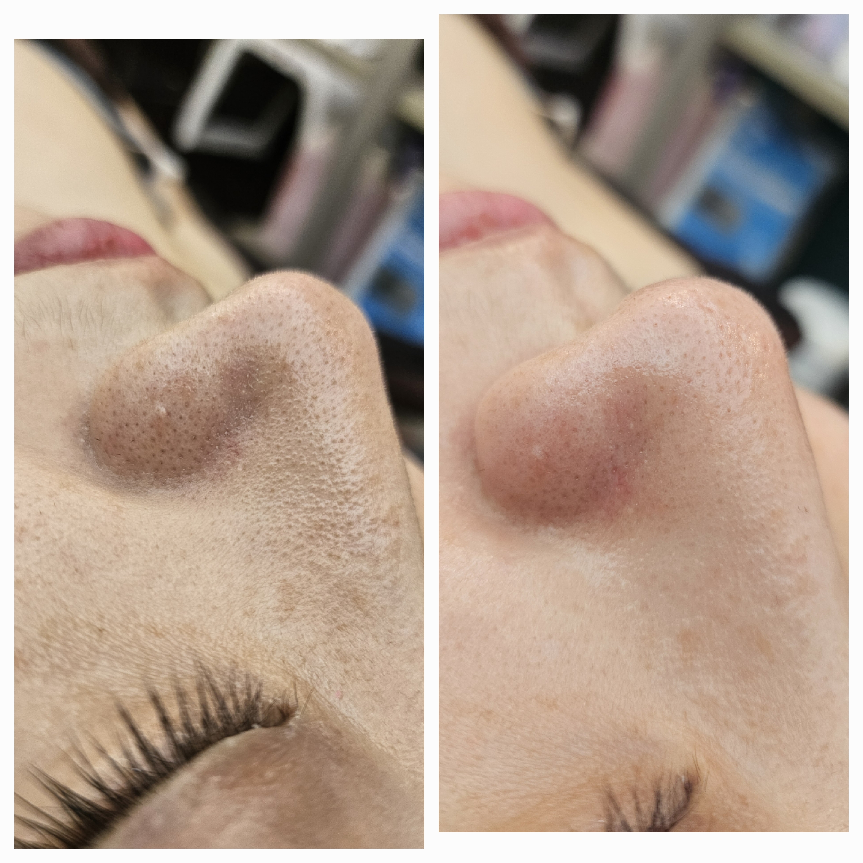 별내 와이뷰라인 사진 2