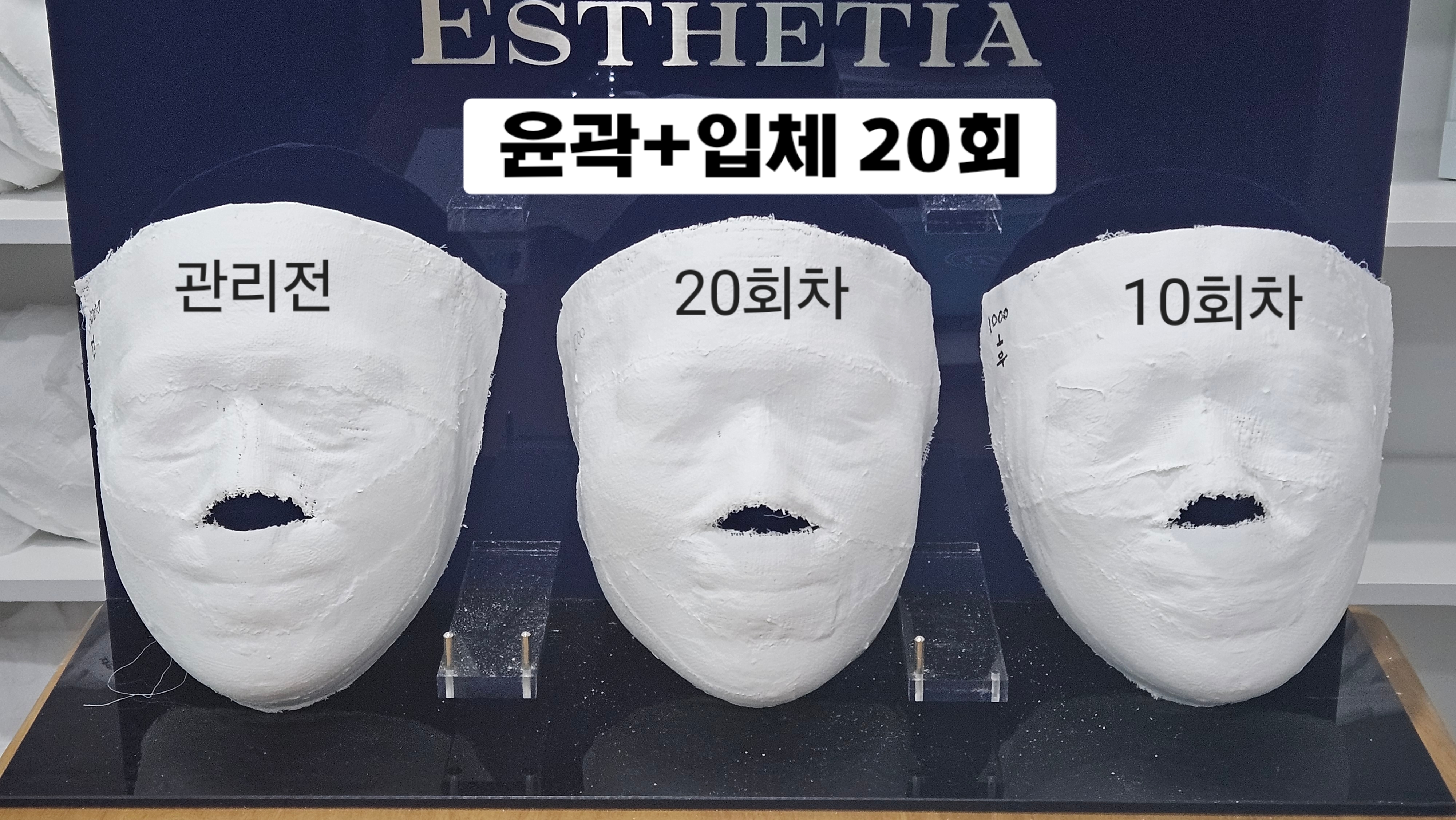 에스테티아 평촌1호점 photo 2