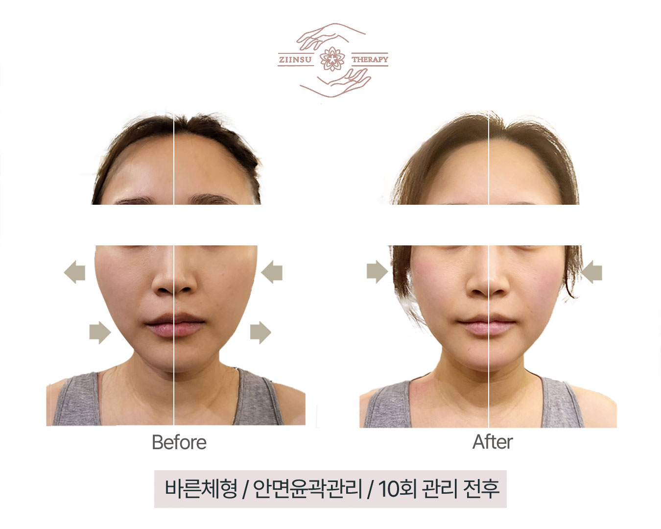 지인수명가 다산점 photo 2