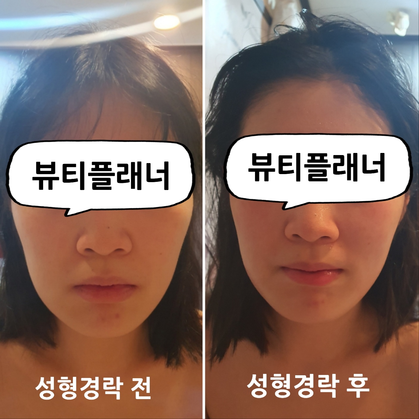 뷰티플래너 용호점 얼굴경락