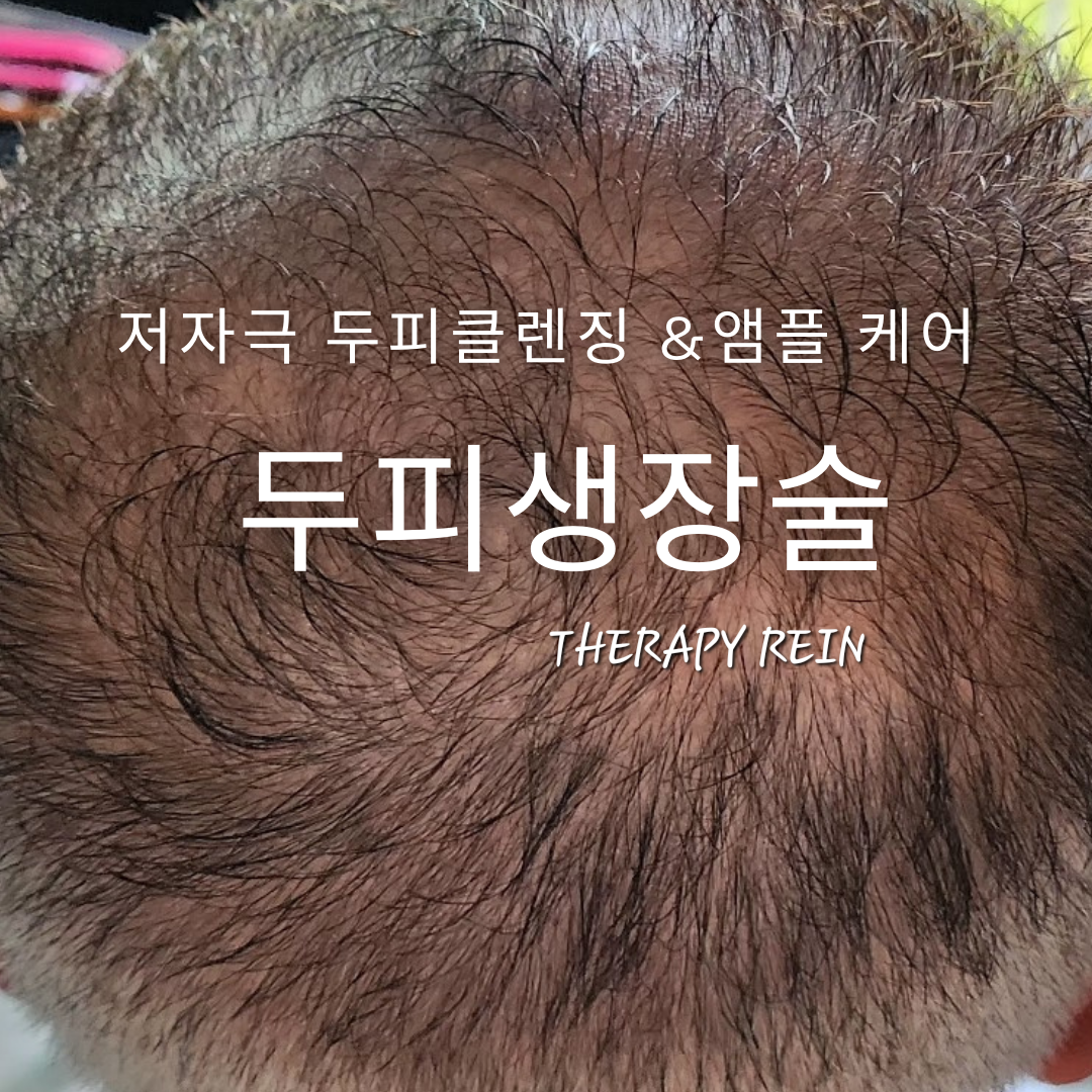 테라피 라인