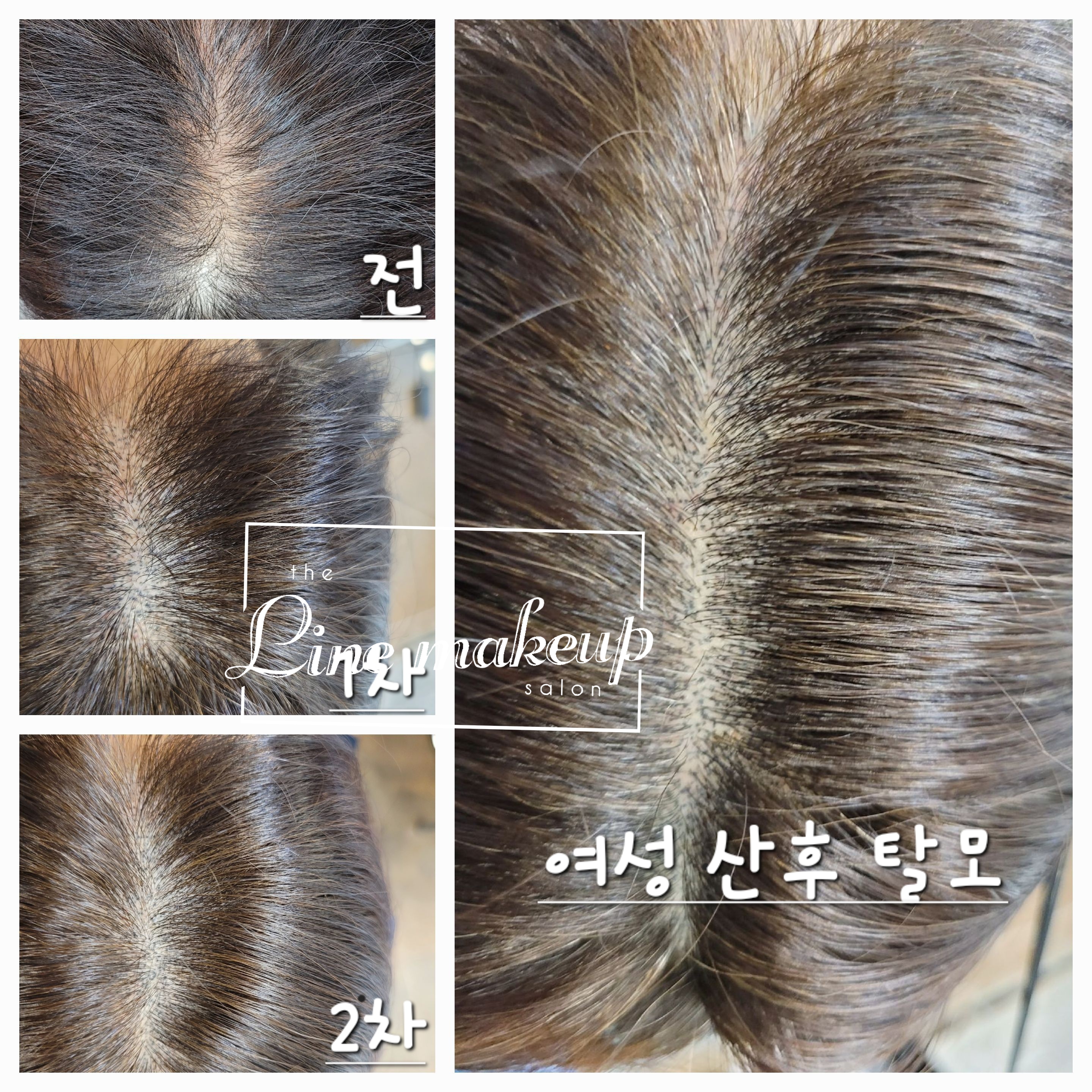 라인메이크업 눈썹 두피탈모전문점 전주점 대표 이미지