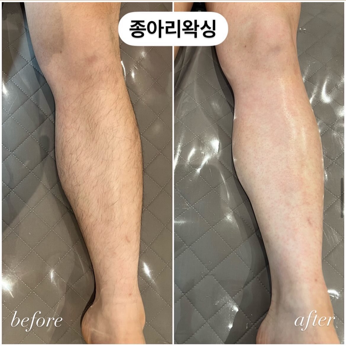 무무왁싱 청담본점 대표 이미지