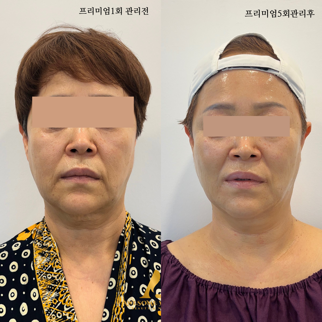 어썸웰스파