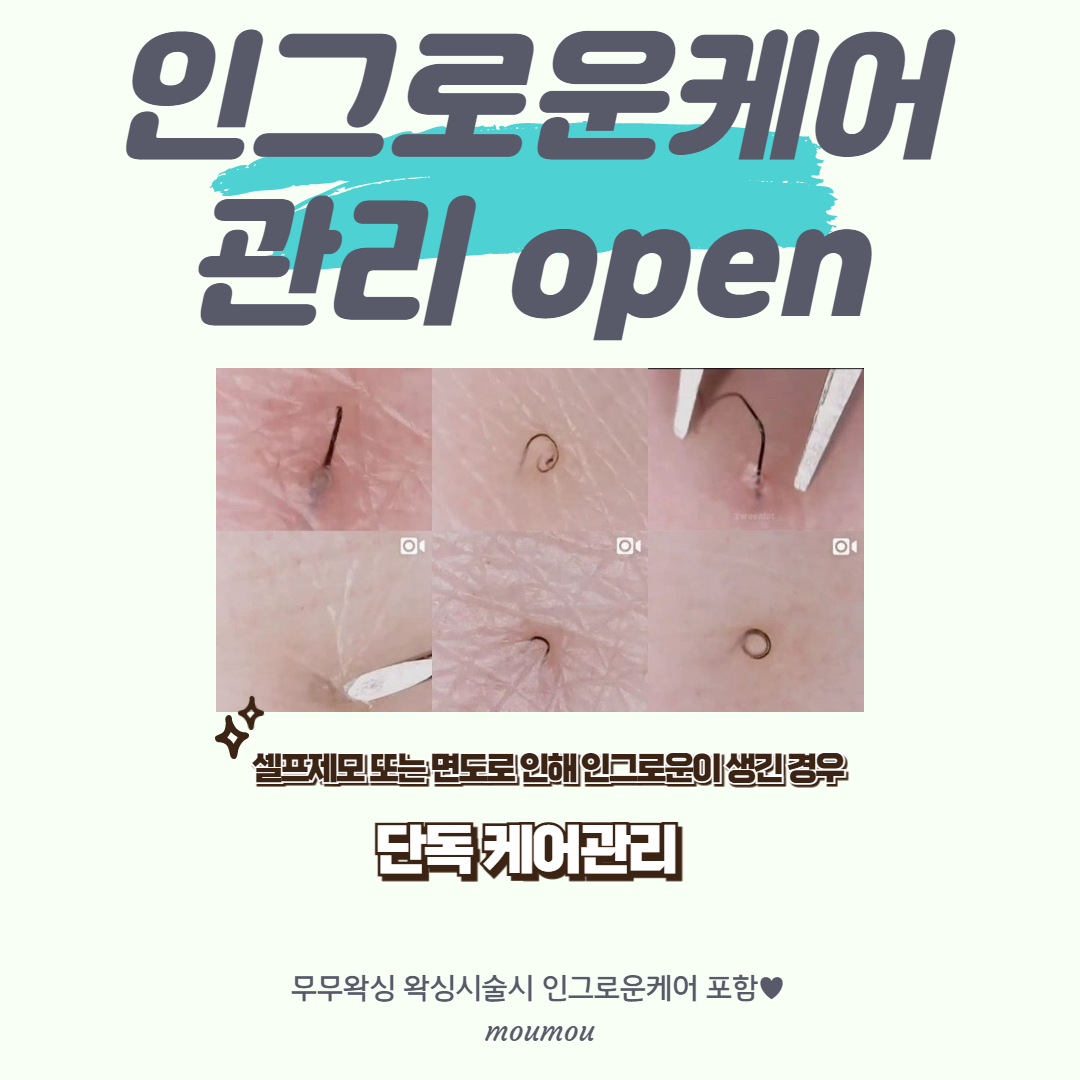 무무왁싱 대표 이미지