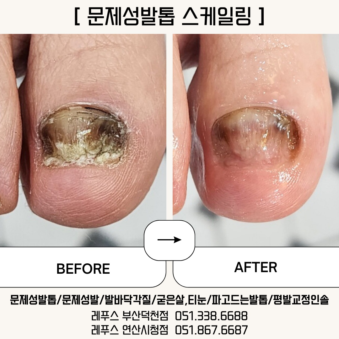 레푸스 부산덕천점