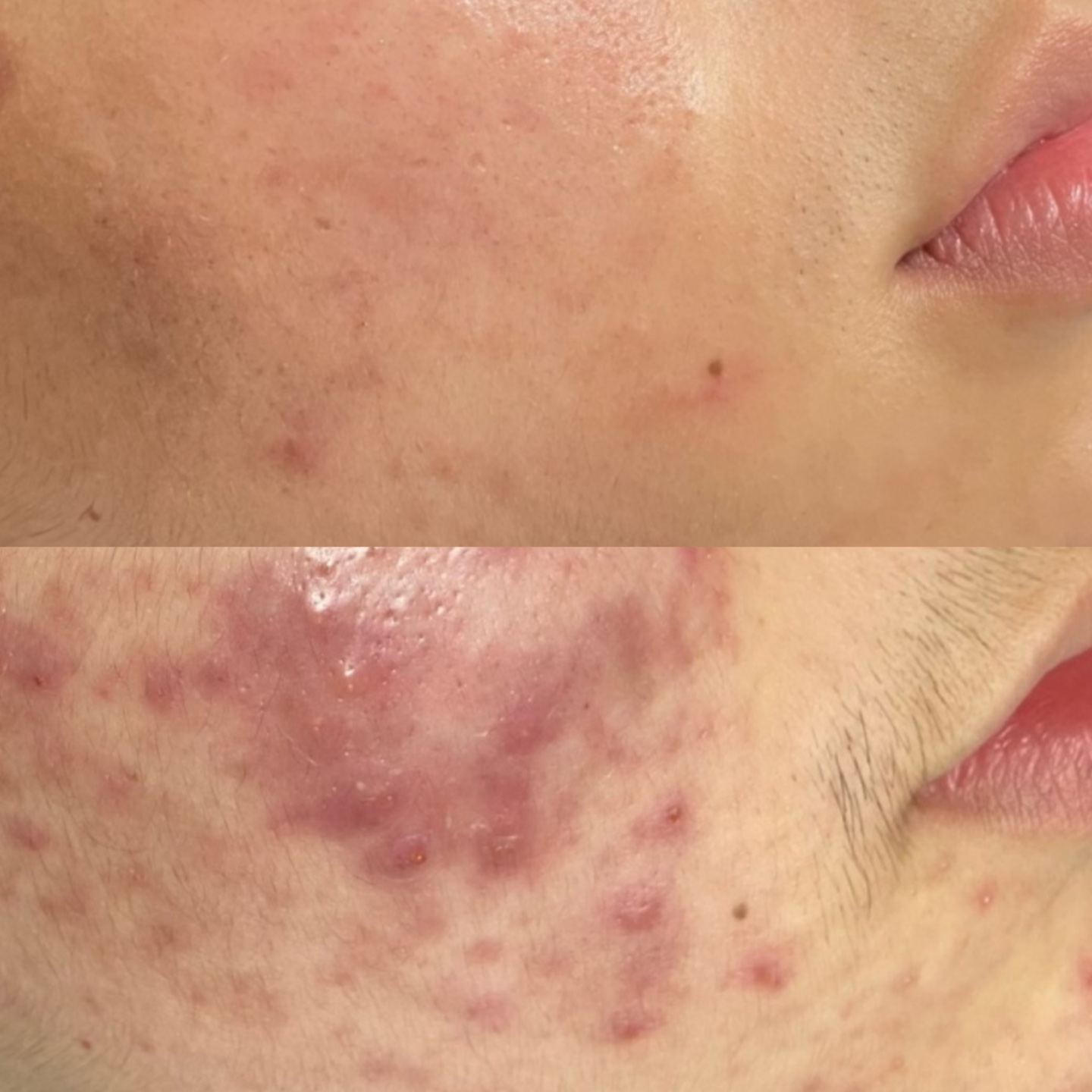 스킨신나라 대표 이미지