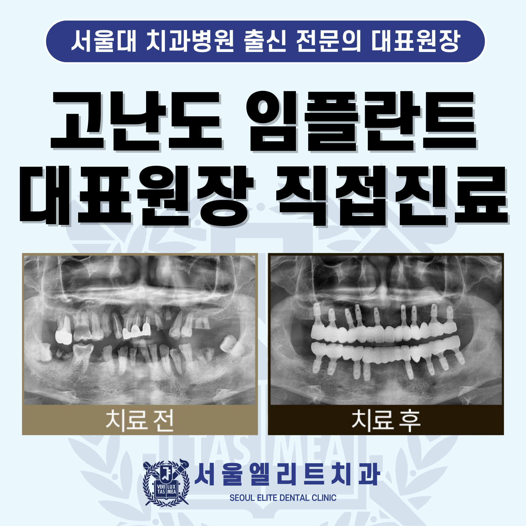 서울엘리트치과의원 대표 이미지