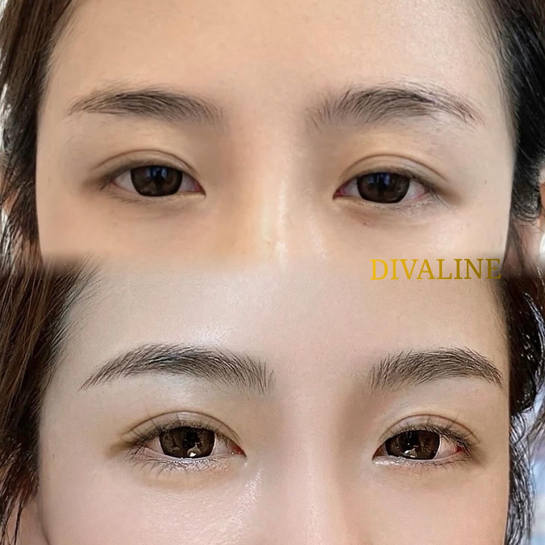 디바라인 서초점 대표 이미지