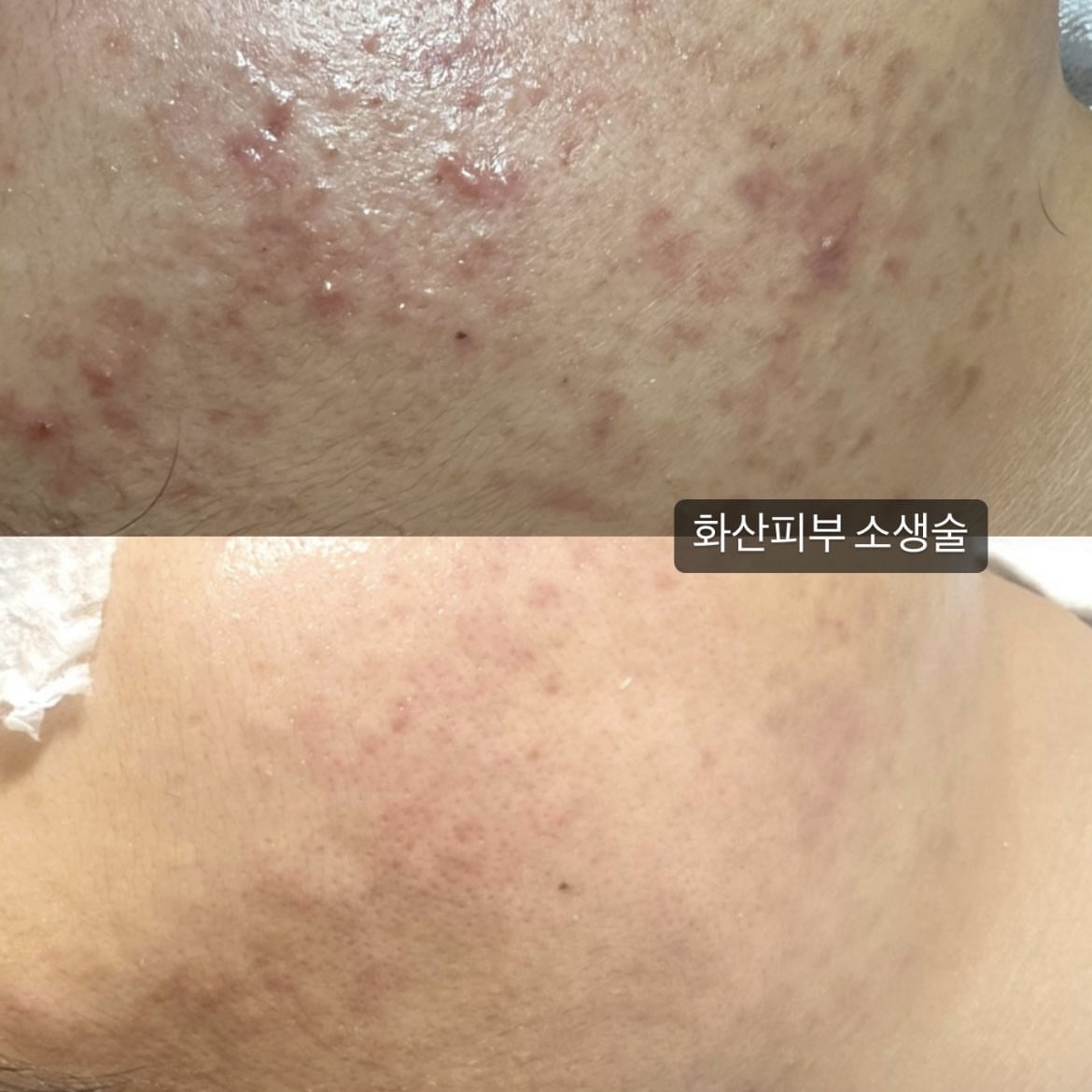 스킨신나라 대표 이미지