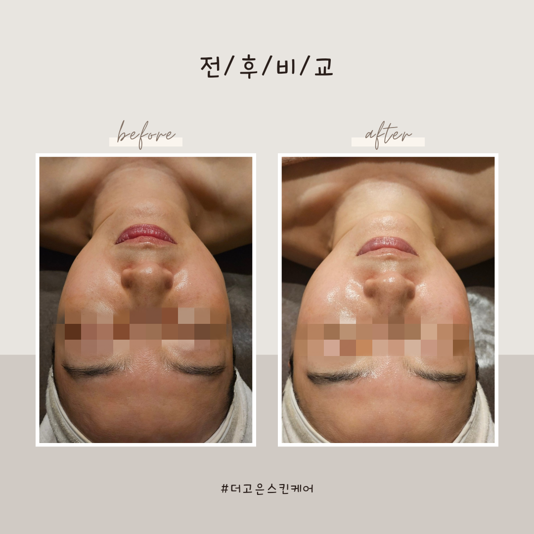 더고은 스킨케어 대표 이미지