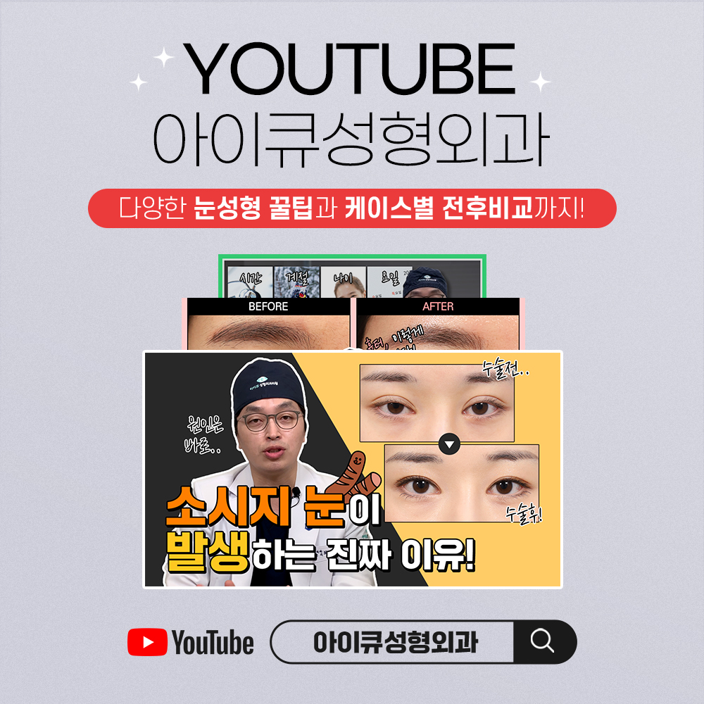 아이큐성형외과의원 대표 이미지