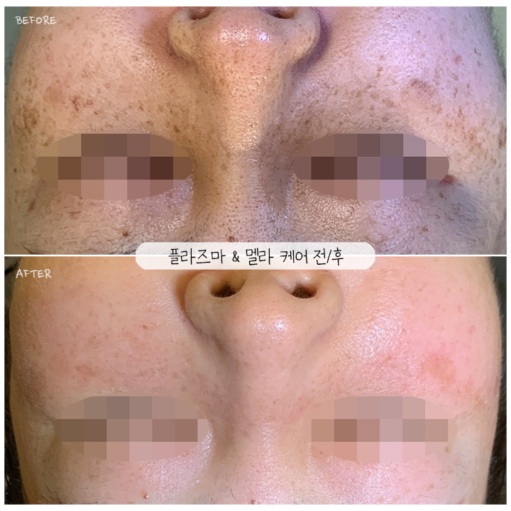 헤세드스킨케어 대표 이미지