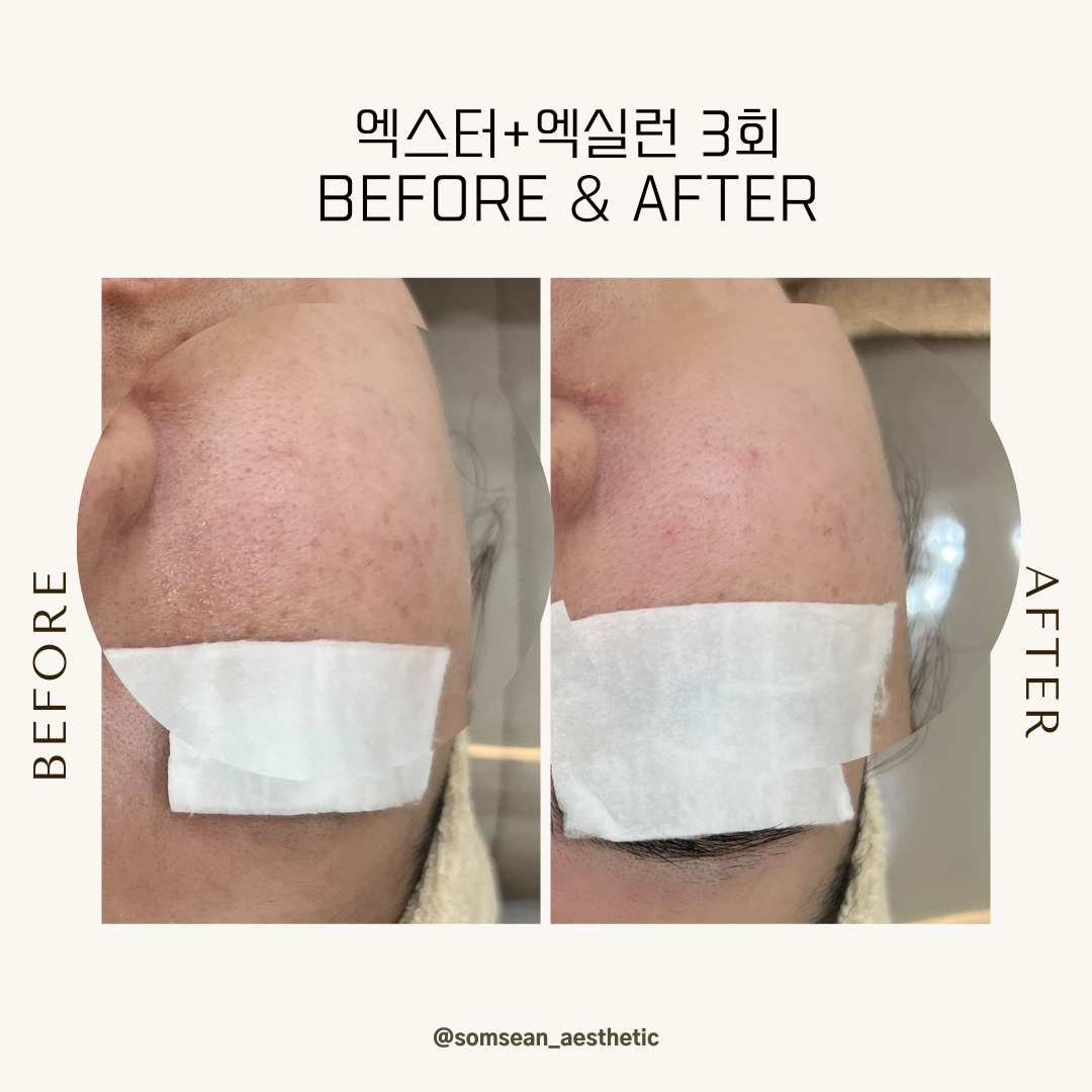 솜세안피부샵 photo 10