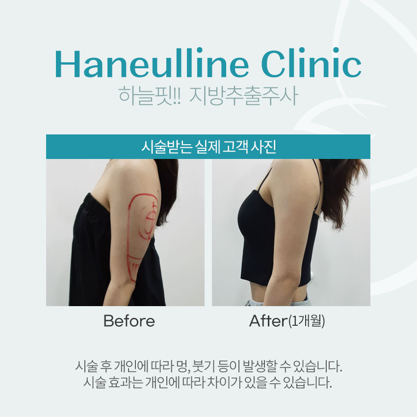 하늘라인의원