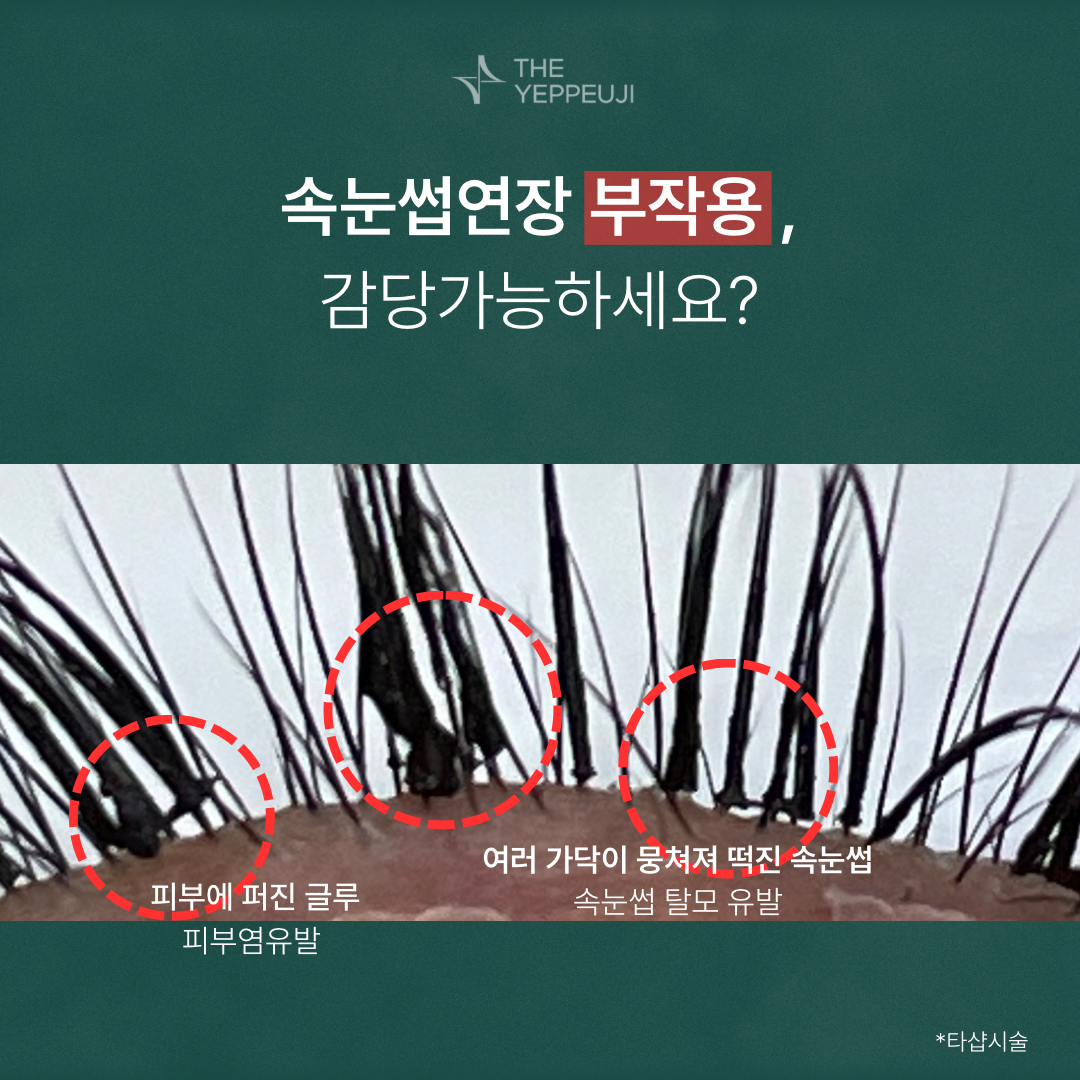 더예쁘지