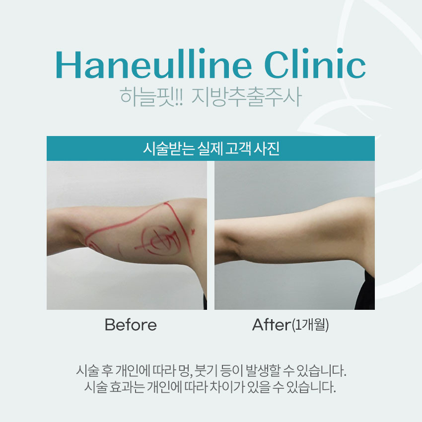 하늘라인의원 대표 이미지