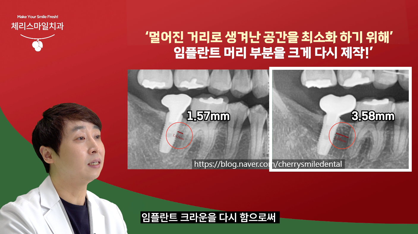 체리스마일치과의원 대표 이미지