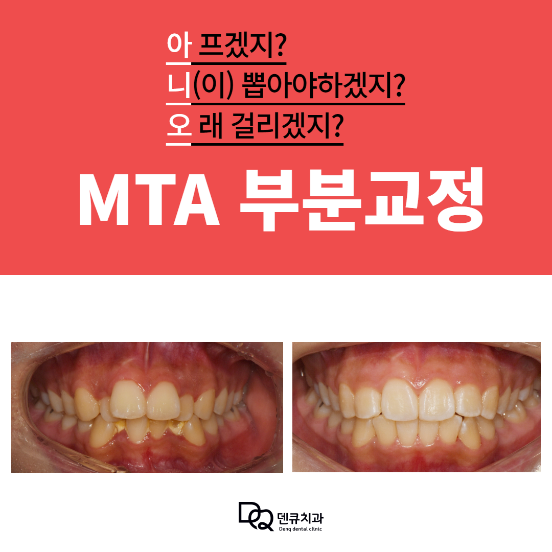 덴큐치과의원 대표 이미지