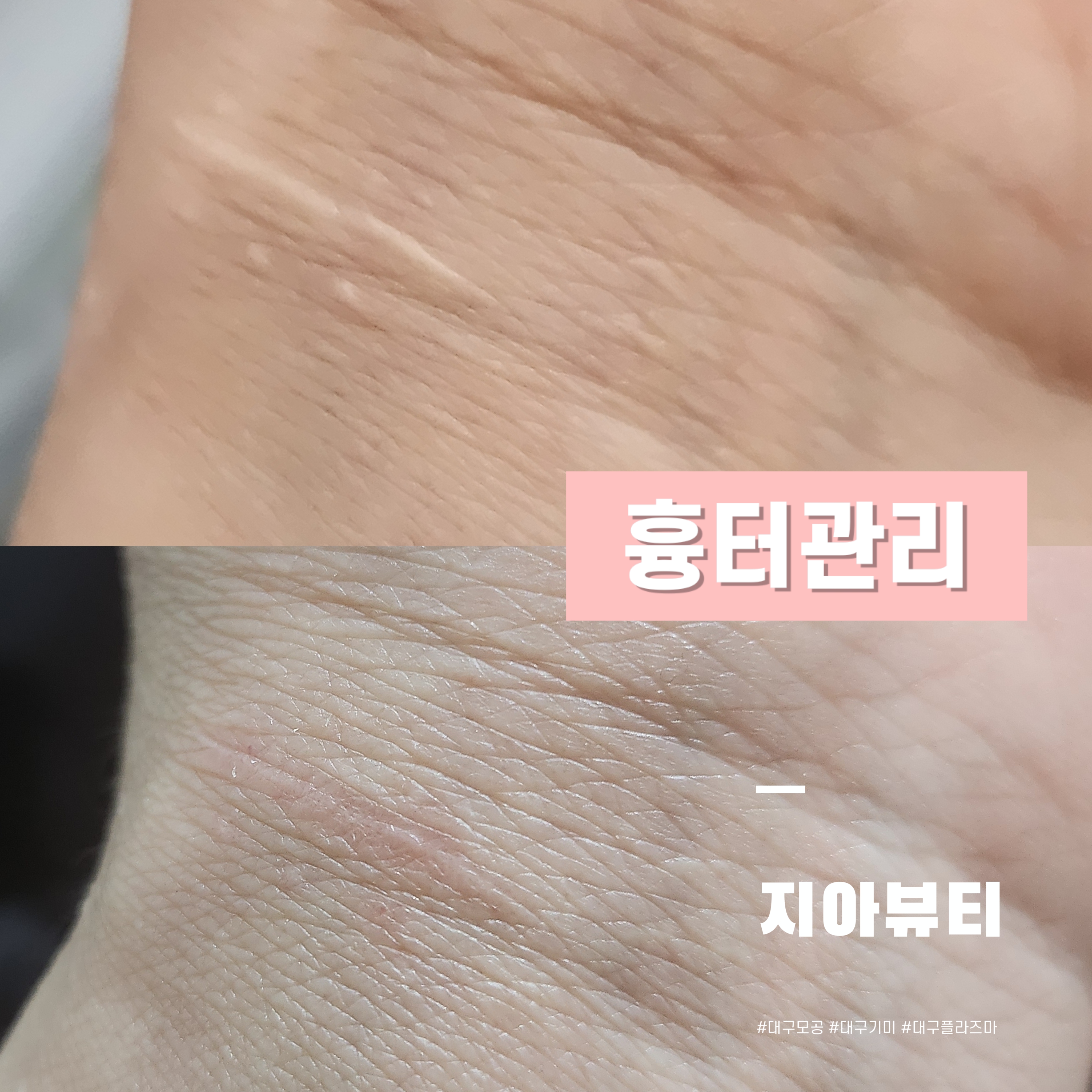 플라즈마블라스트 지아뷰티