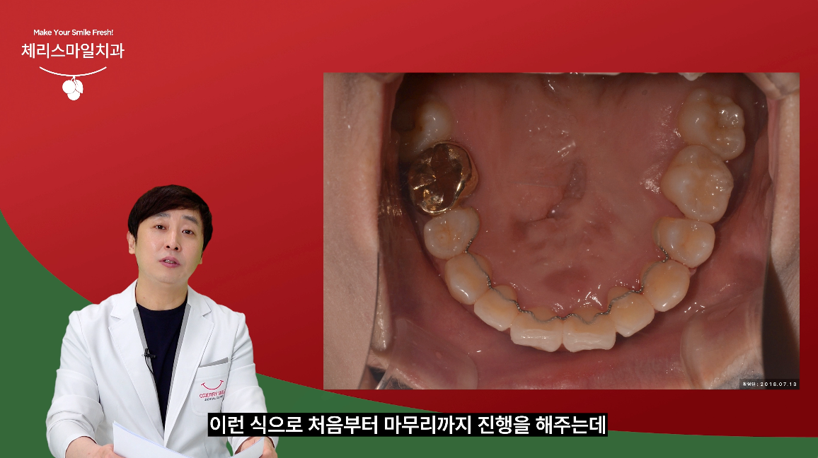 체리스마일치과 대표 이미지