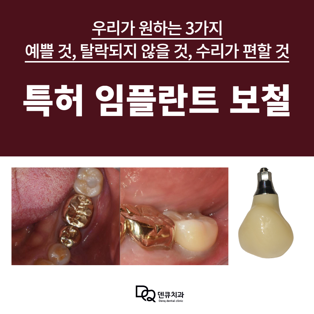 덴큐치과의원 대표 이미지