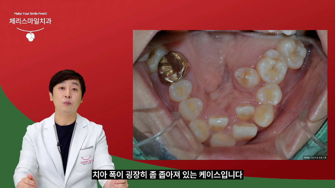 체리스마일치과의원 대표 이미지