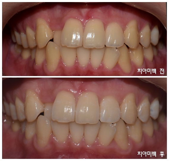 서울부부치과의원 춘천 대표 이미지