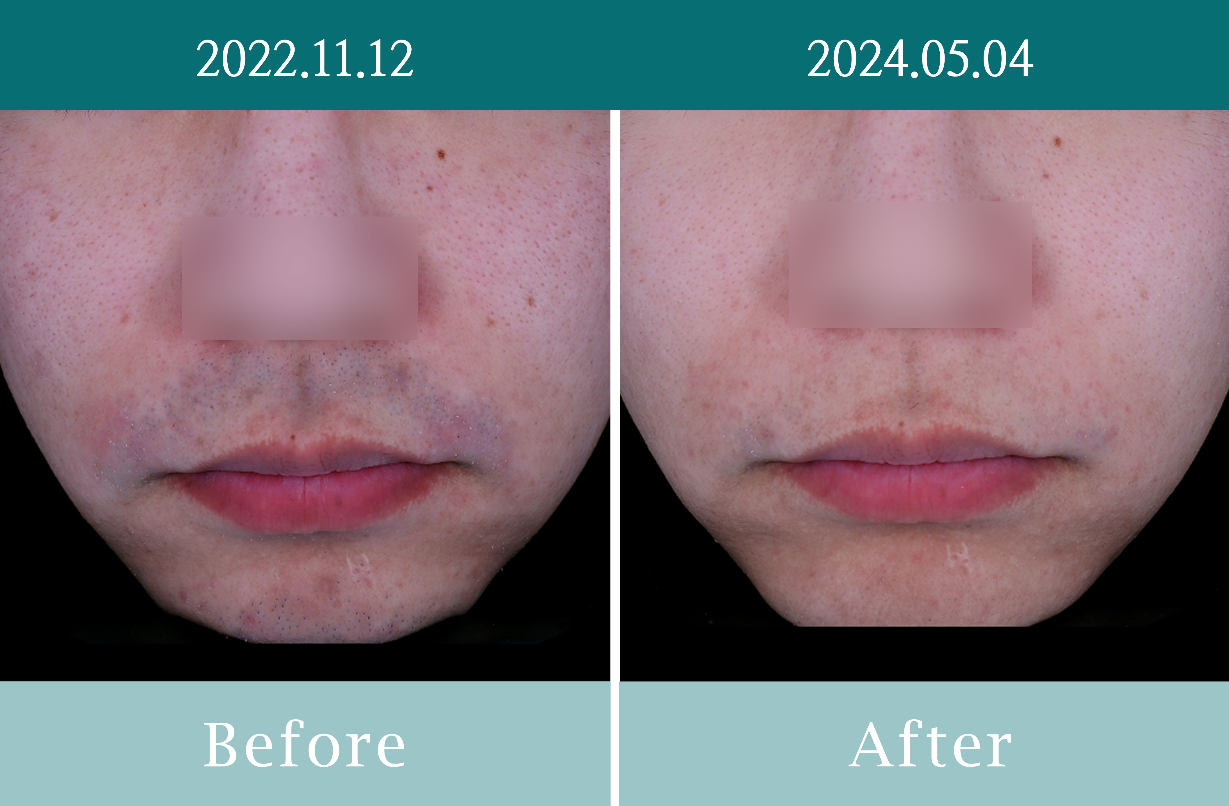 잇츠미의원 동탄 대표 이미지