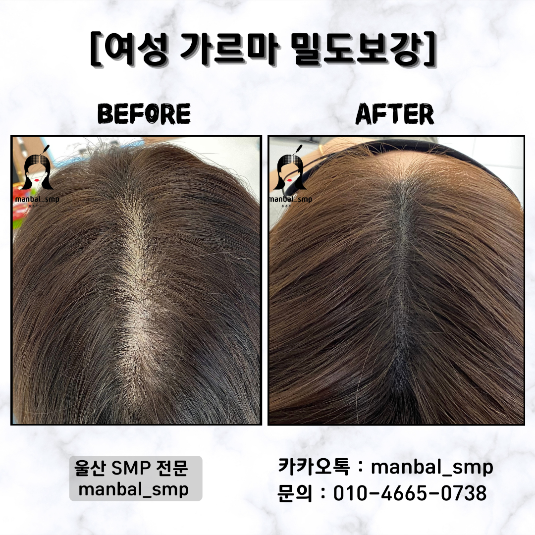 맨발에스엠피