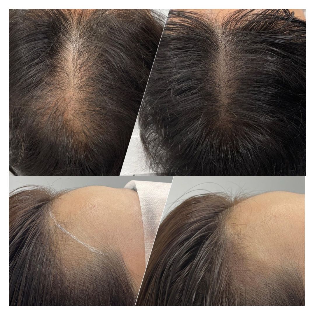 드로잉 대표 이미지