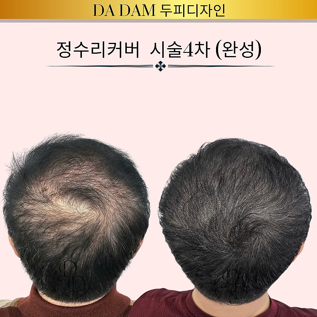 다담두피디자인 대표 이미지