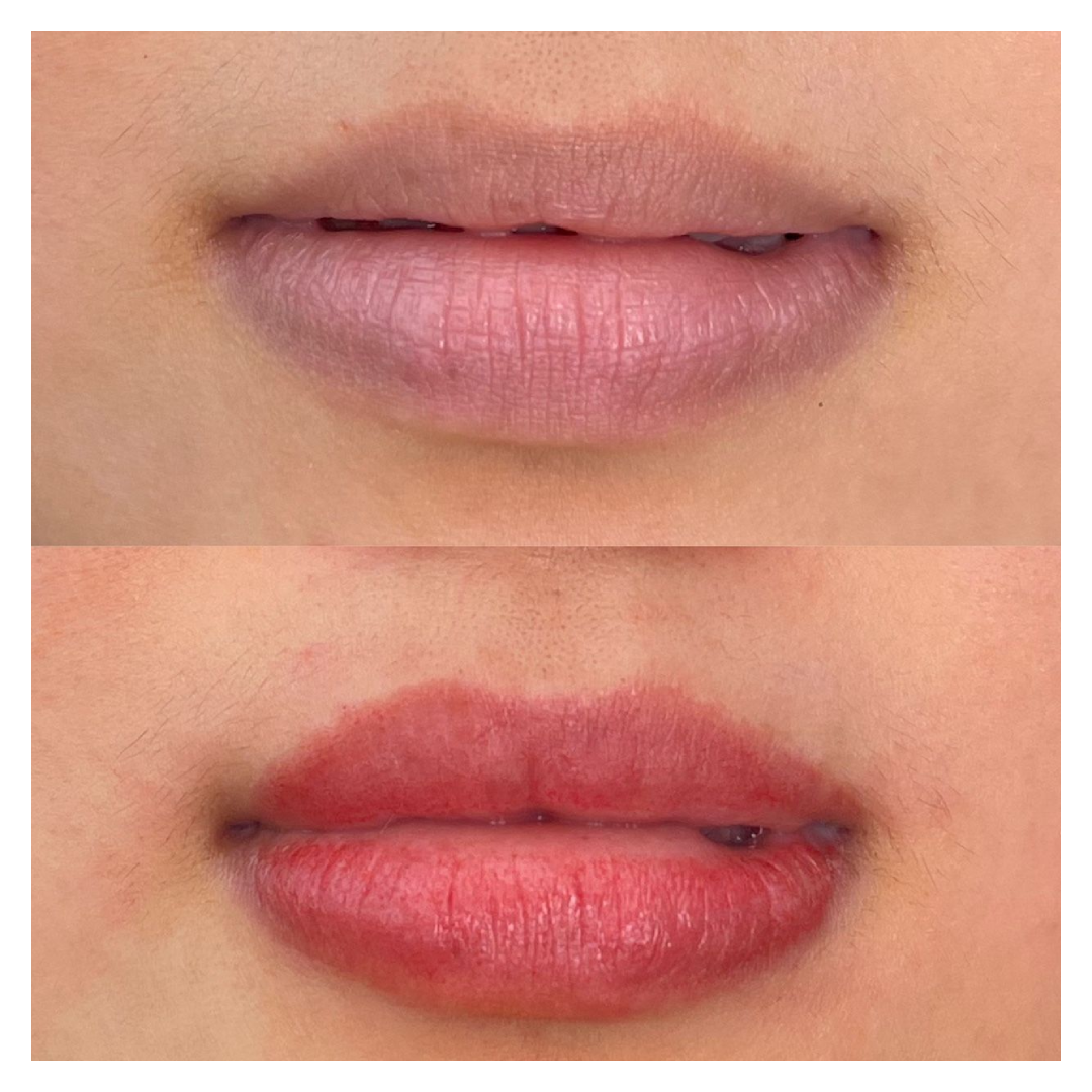 순천 드로잉 두피관리