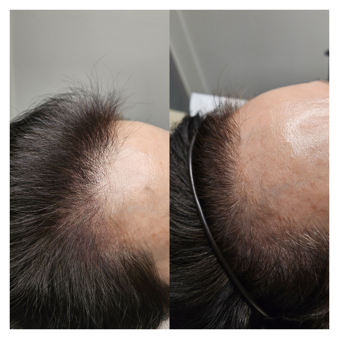 드로잉 대표 이미지