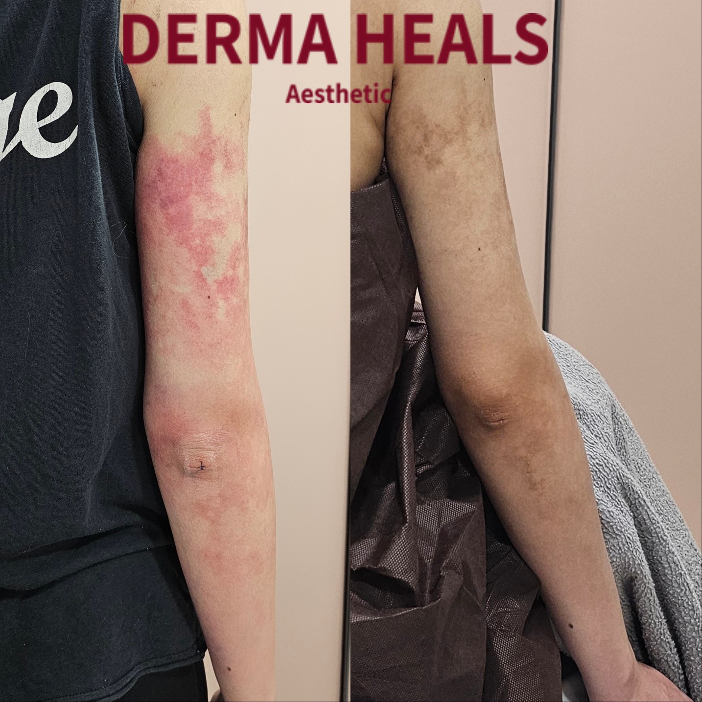 더마힐스 에스테틱 대표 이미지