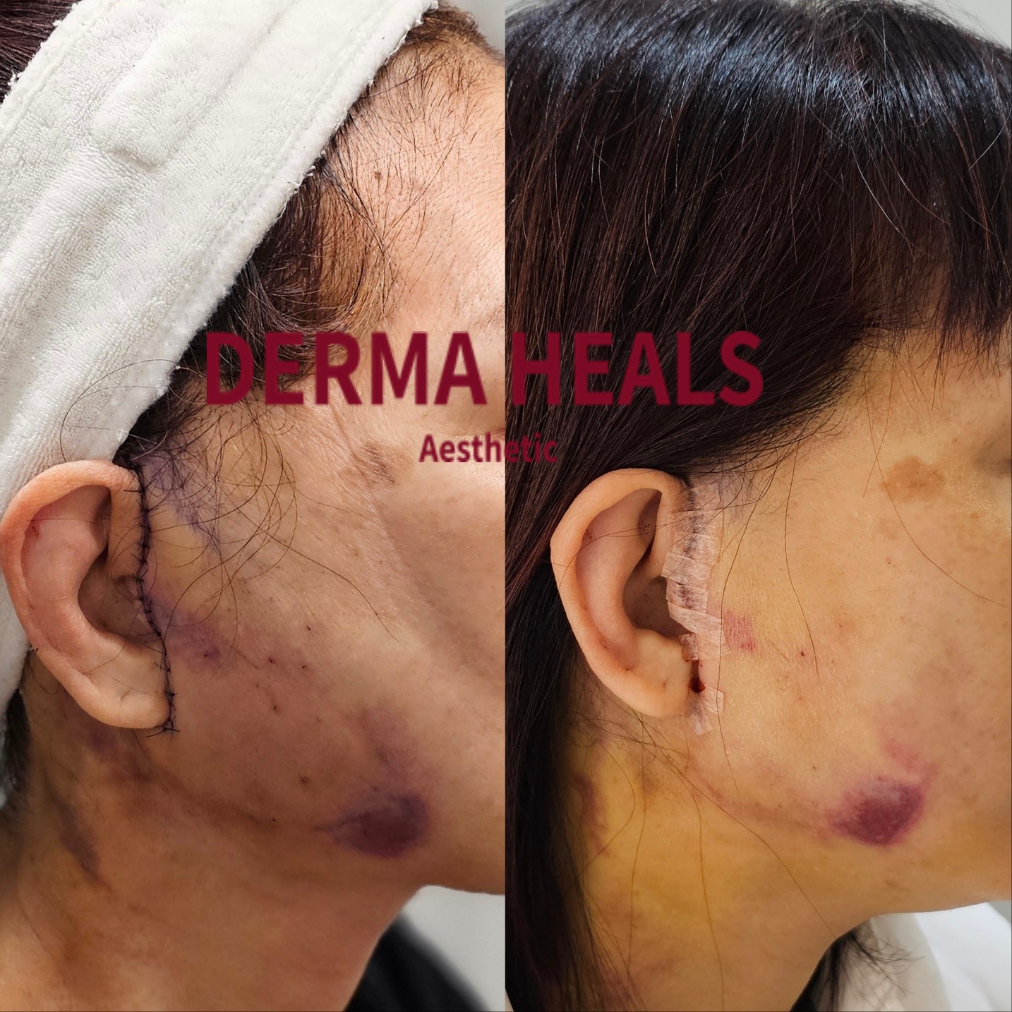 더마힐스 에스테틱 대표 이미지