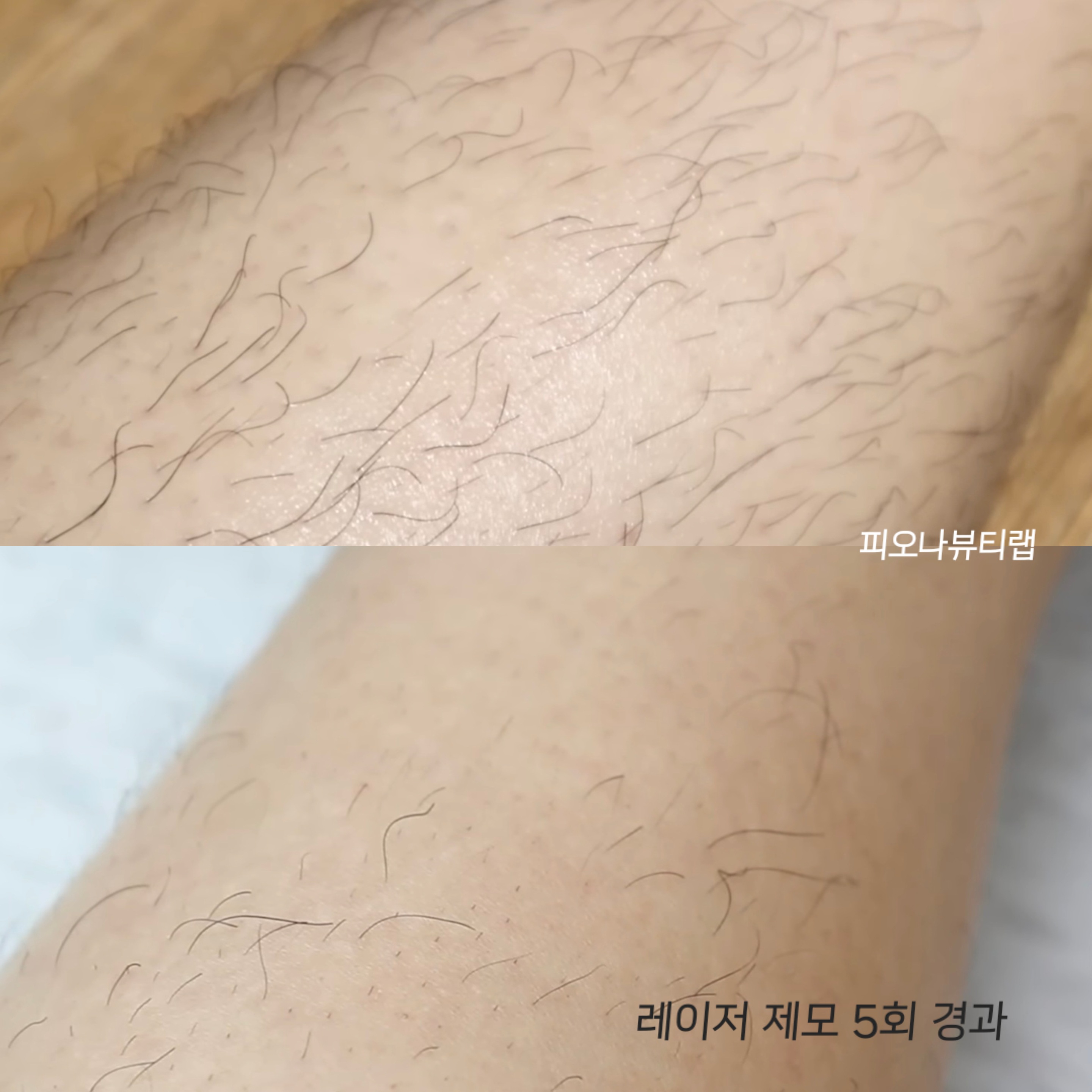 피오나뷰티랩 photo 10