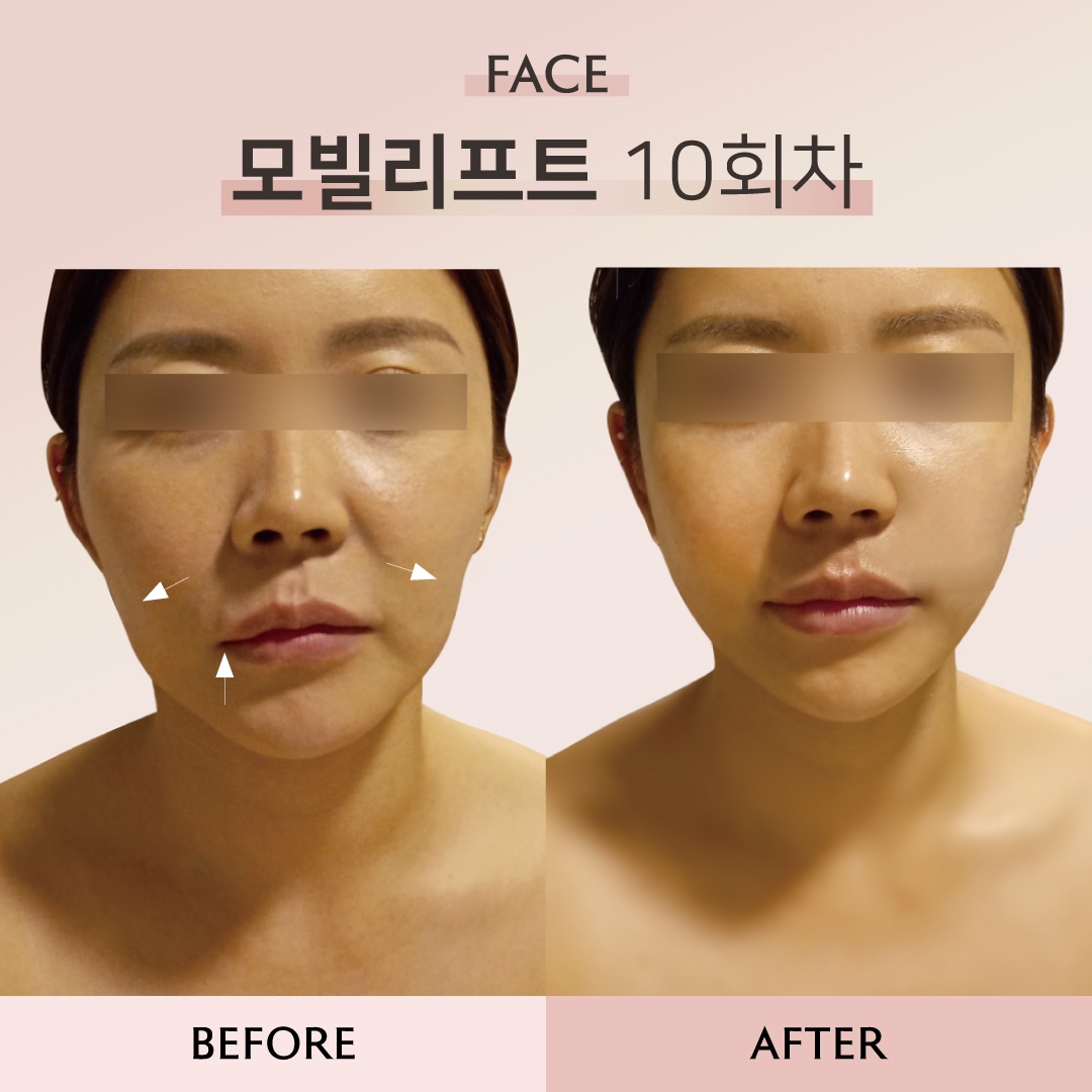 메디스파연 용인기흥역점