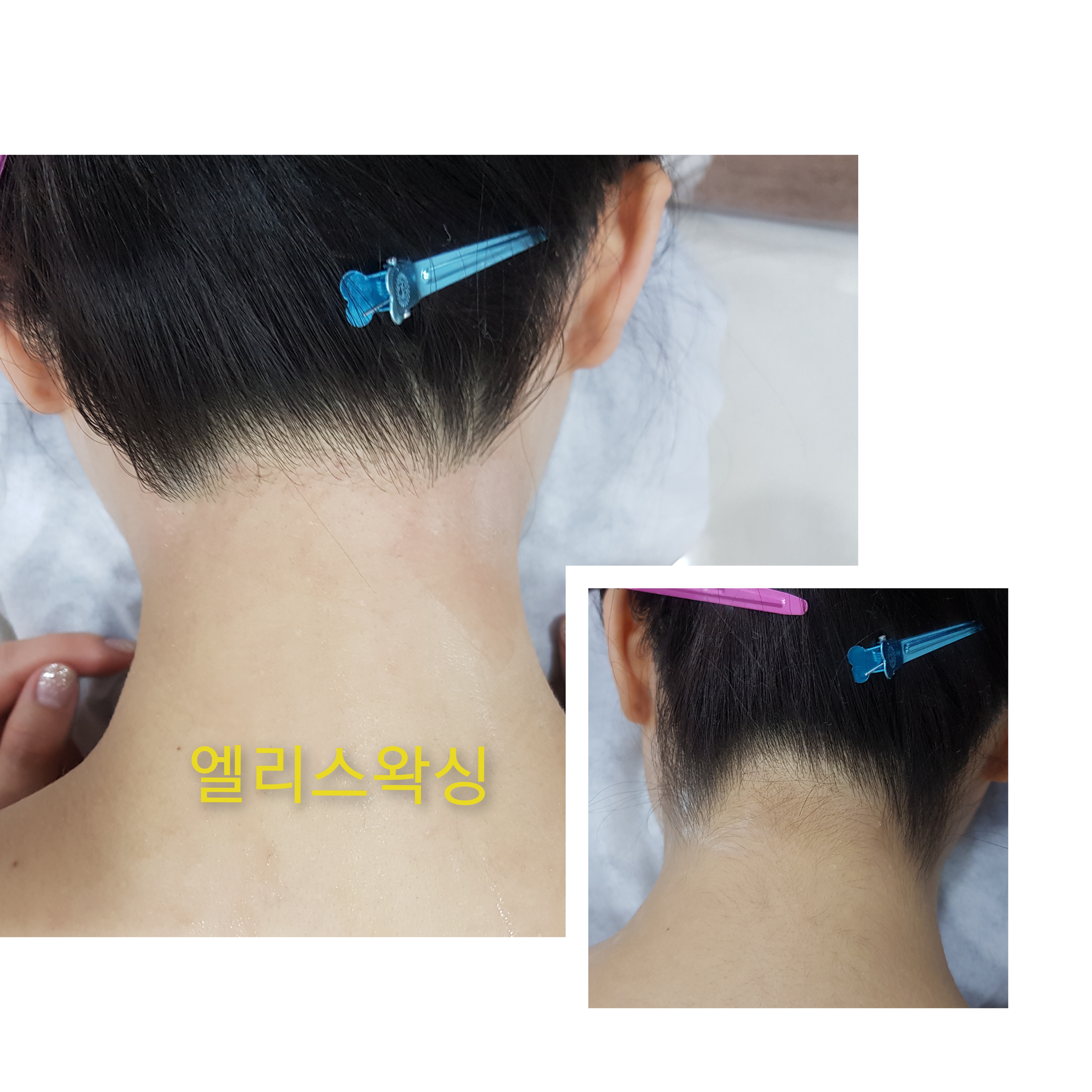 엘리스왁싱 photo 6