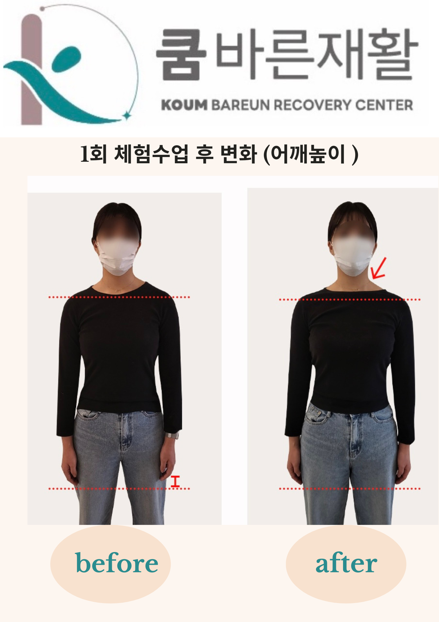 쿰바른재활