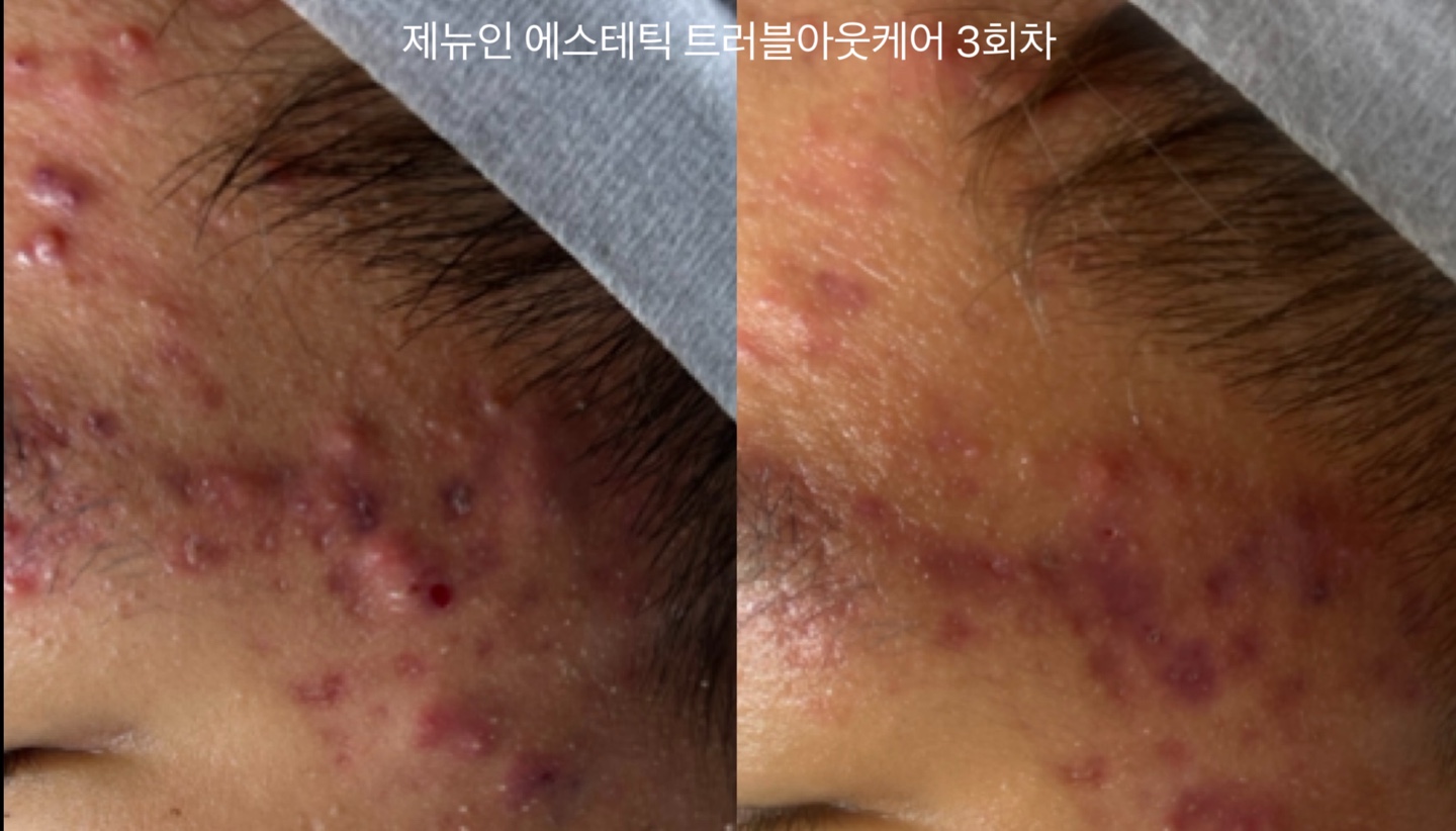 제뉴인 에스테틱